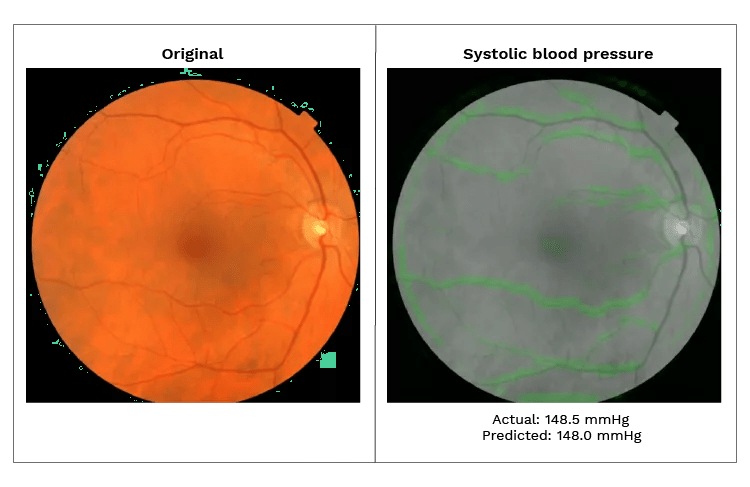 blog-eyes-a-window-into-heart-health