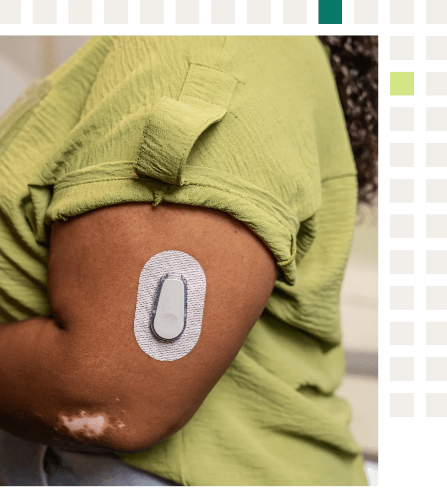 A black woman with type 2 diabetes and obesity wearing a continuous blood monitor for real-time measurements of her blood glucose levels.